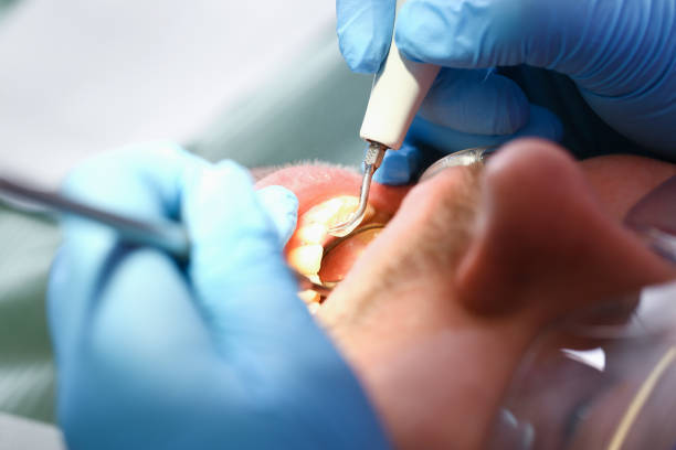 Best Broken or Cracked Tooth Emergency Dentist in Strasburg, OH